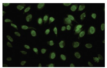 ROD1 (F-30): sc-100845. Immunofluorescence staining of paraformaldehyde-fixed HeLa cells showing nuclear localization.