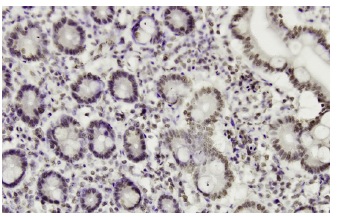 ROD1 (F-30): sc-100845. Immunoperoxidase staining of formalin-fixed, paraffin-embedded human small Intestine tissue showing nuclear localization.