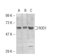ROD1 (F-30): sc-100845. Western blot analysis of ROD1 expression in non-transfected 293T: sc-117752 (A), mouse ROD1 transfected 293T: sc-125943 (B) and HeLa (C) whole cell lysates.