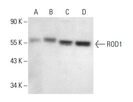 ROD1 (F-30): sc-100845. Western blot analysis of ROD1 expression in non-transfected 293T: sc-117752 (A), mouse ROD1 transfected 293T: sc-125944 (B), HeLa (C) and PC-3 (D) whole cell lysates.