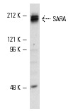 SARA (H-300): sc-9135. Western blot analysis of SARA expression in HeLa whole cell lysate.