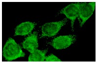 SARA (N-20): sc-8881. Immunofluorescence staining of methanol-fixed HeLa cells showing cytoplasmic staining.