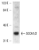 SCCA1/2 (B-9): sc-28384. Western blot analysis of SCCA1/2 expression in A-431 whole cell lysate.