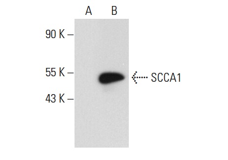 SCCA1/2 (B-9): sc-28384. Western blot analysis of SCCA1 expression in non-transfected: sc-117752 (A) and human SCCA1 transfected: sc-158948 (B) 293T whole cell lysates.