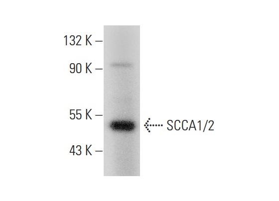 SCCA1/2 (B-9): sc-28384. Western blot analysis of SCCA1/2 expression in Daudi whole cell lysate.