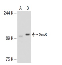 Sec8 (N-15): sc-30291. Western blot analysis of Sec8 expression in non-transfected: sc-117752 (A) and mouse Sec8 transfected: sc-123430 (B) 293T whole cell lysates.