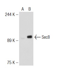 Sec8 (N-15): sc-30291. Western blot analysis of Sec8 expression in non-transfected: sc-117752 (A) and human Sec8 transfected: sc-117287 (B) 293T whole cell lysates.