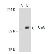 Sec8 (N-15): sc-30291. Western blot analysis of Sec8 expression in non-transfected: sc-117752 (A) and mouse Sec8 transfected: sc-123430 (B) 293T whole cell lysates.