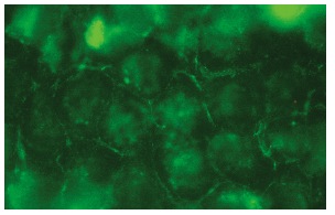 Septin 3 (G-6): sc-74431. Immunofluorescence staining of methanol-fixed HeLa cells showing membrane localization.