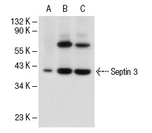 Septin 3 (G-6): sc-74431. Western blot analysis of Septin 3 expression in NTERA-2 cl.D1 whole cell lysate (A) and mouse cerebellum (B) and rat brain (C) tissue extracts.