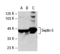 Septin 5 (SP18): sc-20040. Western blot analysis of Septin 5 expression in IMR-32 (A) and SH-SY5Y (B) whole cell lysates and rat brain tissue extract (C).