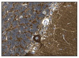 Septin 5 (SP18): sc-20040. Immunoperoxidase staining of formalin fixed, paraffin-embedded human cerebellum tissue showing cytoplasmic staining of cells in granular and molecular layers and Purkinje cells at high magnification. Kindly provided by The Swedish Human Protein Atlas (HPA) program.
