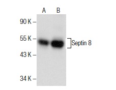 Septin 8 (C-5): sc-390074. Western blot analysis of Septin 8 expression in rat testis (A) and mouse testis (B) tissue extracts.