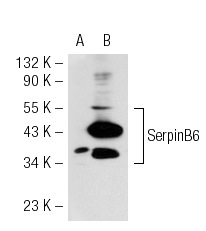 SerpinB6 (F-12): sc-21143. Western blot analysis of SerpinB6 expression in non-transfected: sc-117752 (A) and mouse SerpinB6 transfected: sc-123498 (B) 293T whole cell lysates.