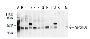 SerpinB8 (PI-8): sc-101371. Western blot analysis of SerpinB8 expression in mucosa oropharynx (A), spleen (B), placenta (C), pituitary glad (D), epidermis (E), stomach (F), colon (G), lung (H), kidney (I), liver (J), heart (K), brain (L) and pancreas (M) human tissue lysates. Reproduced, with permission, from Strik MC, Bladergroen BA, Wouters D, Kisiel W, Hooijberg JH, Verlaan AR, Hordijk PL, Schneider P, Hack CE, Kummer JA: Distribution of the human intracellular serpin protease inhibitor 8 in human tissues. Journal of Histochemistry & Cytochemistry. 50(11):1443-54, 2002.