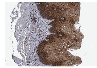 SerpinB8 (PI-8): sc-101371. Immunoperoxidase staining of formalin fixed, paraffin-embedded human esophagus showing nuclear and cytoplasmic staining of squamous epithelial cells at low magnification. Kindly provided by The Swedish Human Protein Atlas (HPA) program.