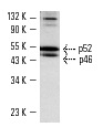 Shc (C-20): sc-288. Western blot analysis of Shc expression in SK-BR-3 whole cell lysate.