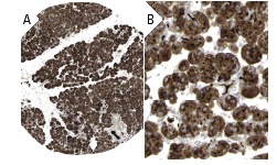 Shc (C-20): sc-288. Immunoperoxidase staining of formalin fixed, paraffin-embedded human pancreas tissue showing cytoplasmic staining in exocrine pancreas and islet cells at low (A) and high (B) magnification. Kindly provided by The Swedish Human Protein Atlas (HPA) program.