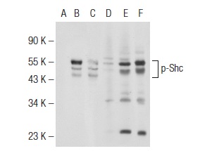 Western blot analysis of Shc phosphorylation in untreated (A,D), EGF treated (B,E) and EGF and lambda protein phosphatase treated (C,F) HEK293 whole cell lysates. Antibodies tested include p-Shc (15E11): sc-81518 (A,B,C) and Shc (H-108): sc-1695 (D,E,F).