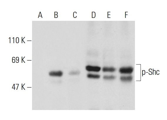 Western blot analysis of Shc phosphorylation in untreated (A,D), serum starved and EGF treated (B,E) and serum starved, EGF and lambda protein phosphatase treated (C,F) HEK293 whole cell lysates. Antibodies tested include p-Shc (Tyr 239/240)-R: sc-18074-R (A,B,C) and Shc (H-108): sc-1695 (D,E,F).