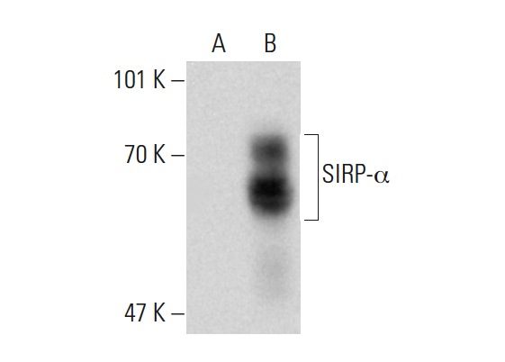 SIRP-α1 (SE7C2): sc-23863. Western blot analysis of SIRP-α expression in non-transfected: sc-117752 (A) and human SIRP-α transfected: sc-159295 (B) 293T whole cell lysates.