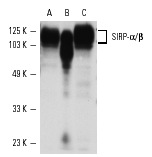 SIRP-α/β (A-1): sc-17803. Western blot analysis of SIRP-α/β expression in THP-1 (A), AML-193 (B) and HL-60 (C) whole cell lysates.