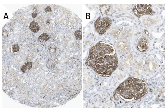 SIRP-α/β (A-1): sc-17803. Immunoperoxidase staining of formalin fixed, paraffin-embedded human kidney tissue showing membrane staining of cells in glomeruli and tubules (low and high magnification). Kindly provided by The Swedish Human Protein Atlas (HPA) program.