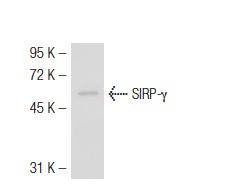 SIRP-γ (OX117): sc-53112. Western blot analysis of SIRP-γ expression in AML-193 whole cell lysate.