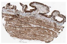 SIRT2 (A-5): sc-28298 Immunoperoxidase staining of formalin fixed, paraffin-embedded human gall bladder tissue showing cytoplasmic and membrane staining of glandular cells. Kindly provided by The Swedish Human Protein Atlas (HPA) program.