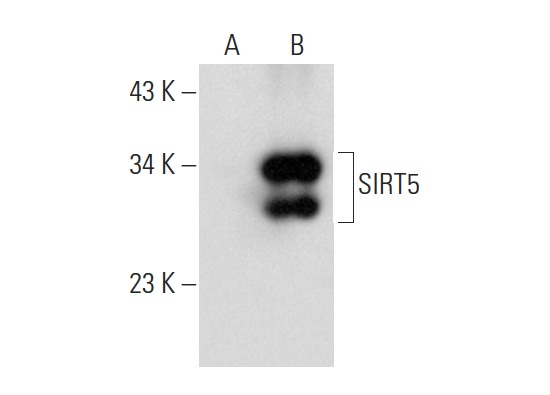 SIRT5 (G-2): sc-271635. Western blot analysis of SIRT5 expression in non-transfected: sc-117752 (A) and mouse SIRT5 transfected: sc-123559 (B) 293T whole cell lysates.