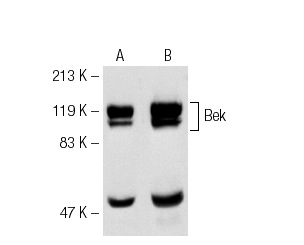 Western blot analysis of Bek transfected NIH/3T3 cells (A,B). Antibodies tested include Bek (C-8): sc-6930 (A) and Bek (C-17): sc-122 (B).