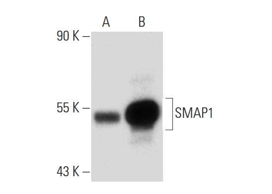 SMAP1 (Q-18): sc-162230. Western blot analysis of SMAP1 expression in non-transfected: sc-117752 (A) and mouse SMAP1 transfected: sc-110204 (B) 293T whole cell lysates.