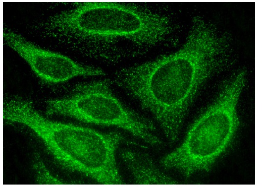SMAP1 (N-12): sc-162229. Immunofluorescence staining of methanol-fixed HeLa cells showing cytoplasmic localization.