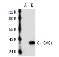 SMS1 (H-130): sc-67097. Western blot analysis of SMS1 expression in non-transfected: sc-117752 (A) and mouse SMS1 transfected: sc-123665 (B) 293T whole cell lysates.