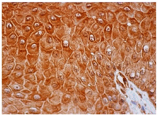 SMS1 (H-130): sc-67097. Immunoperoxidase staining of formalin fixed, paraffin-embedded human oral mucosa tissue showing cytoplasmic staining of squamous epithelial cells.
