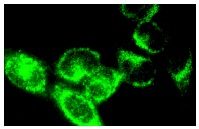 SOCS-1 (H-93): sc-9021. Immunofluorescence staining of methanol-fixed HeLa + IFN-γ cells showing cytoplasmic localization.