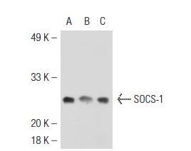 SOCS-1 (H-93): sc-9021. Western blot analysis of SOCS-1 expression in HeLa (A), JAR (B) and JEG-3 (C) whole cell lysates.