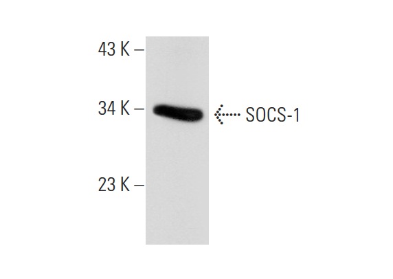 SOCS-1 (H-93): sc-9021. Western blot analysis of SOCS-1 expression in mouse PBL whole cell lysate.