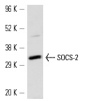 SOCS-2 (H-74): sc-9022. Western blot analysis of SOCS-2 expression in mouse heart tissue extract.