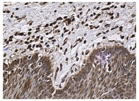 SOCS-2 (H-74): sc-9022. Immunoperoxidase staining of formalin fixed, paraffin-embedded human esophagus tissue showing cytoplasmic staining of squamous epithelial cells.