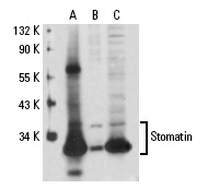 Stomatin (M-14): sc-48308. Western blot analysis of Stomatin expression in non-transfected: sc-110760 (A), human Stomatin transfected: sc-111162 (B) and HeLa (C) whole cell lysates.