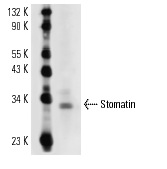 Stomatin (M-14): sc-48308. Western blot analysis of Stomatin expression in MEG-01 whole cell lysate.