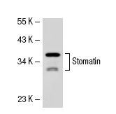 Stomatin (M-14): sc-48308. Western blot analysis of Stomatin expression in HeLa whole cell lysate.