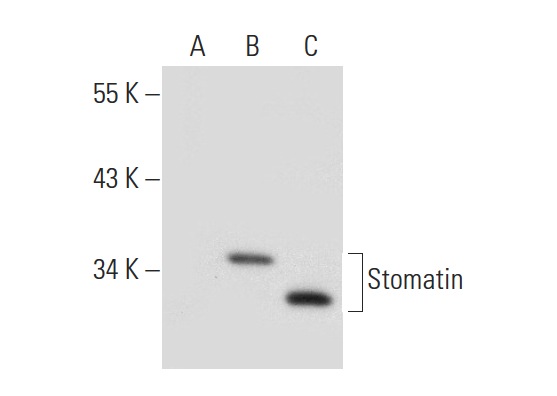 Stomatin (M-14): sc-48308. Western blot analysis of Stomatin expression in non-transfected 293T: sc-117752 (A), human Stomatin transfected 293T: sc-170531 (B) and HeLa (C) whole cell lysates.