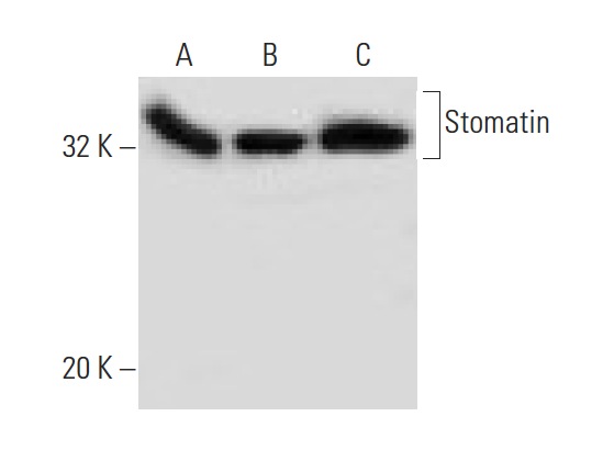 Stomatin (M-14): sc-48308. Western blot analysis of Stomatin expression in MEG-01 (A), WI 38 (B) and Hep G2 (C) whole cell lysates.