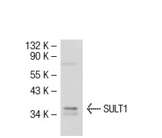 SULT1 (H-55): sc-32928. Western blot analysis of SULT1 expression in Hep G2 whole cell lysate.