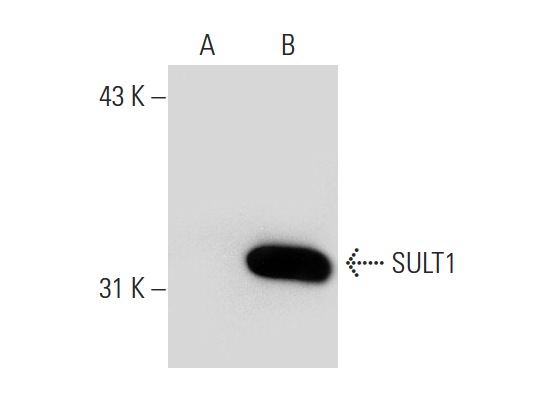 SULT1 (H-55): sc-32928. Western blot analysis of SULT1 expression in non-transfected: sc-110760 (A) and human SULT1 transfected: sc-110796 (B) 293 whole cell lysates.