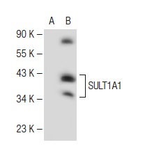 SULT1 (H-55): sc-32928. Western blot analysis of SULT1A1 expression in non-transfected: sc-117752 (A) and human SULT1A1 transfected: sc-174235 (B) 293T whole cell lysates.