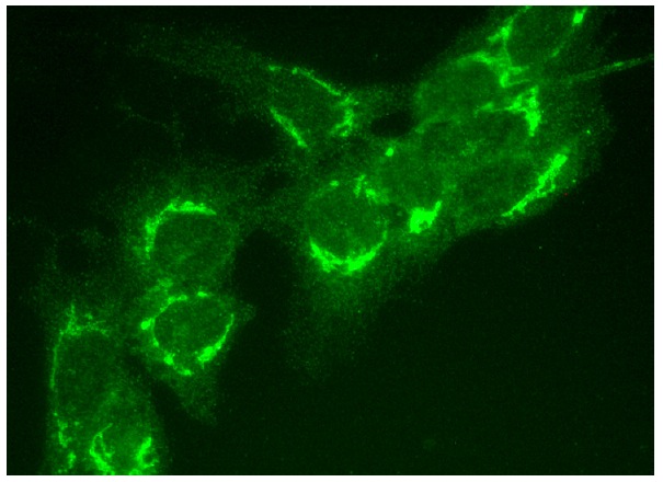 SULT1 (H-55): sc-32928. Immunofluorescence staining of formalin-fixed HepG2 cells showing cytoplasmic localization.