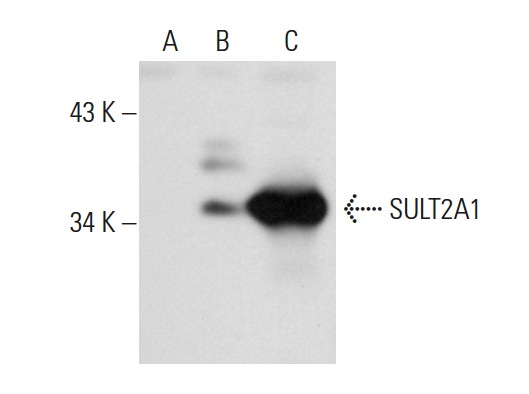 SULT2A1 (FL-285): sc-32941. Western blot analysis of SULT2A1 expression in non-transfected 293T: sc-117752 (A), human SULT2A1 transfected 293T: sc-174555 (B) and Hep G2 (C) whole cell lysates.